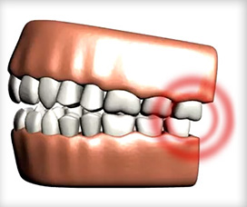holistiholistic-dentistry-west-kelownac-dentistry-west-kelowna