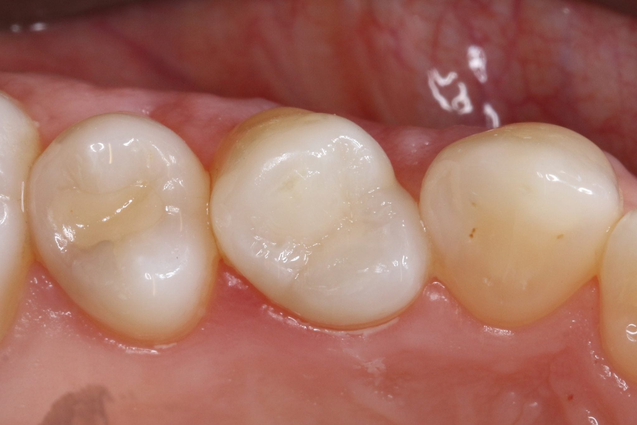 holistiholistic-dentistry-west-kelownac-dentistry-west-kelowna